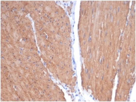 Smooth MuscleMyosin Heavy Chain (SM-MHC) (Leiomyosarcoma and Myoepithelial Cell Marker) Antibody in Immunohistochemistry (Paraffin) (IHC (P))