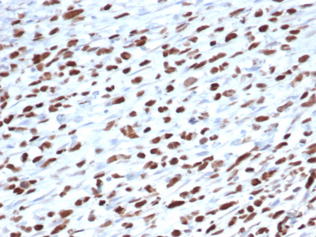 MyoD1 (Rhabdomyosarcoma Marker) Antibody in Immunohistochemistry (Paraffin) (IHC (P))