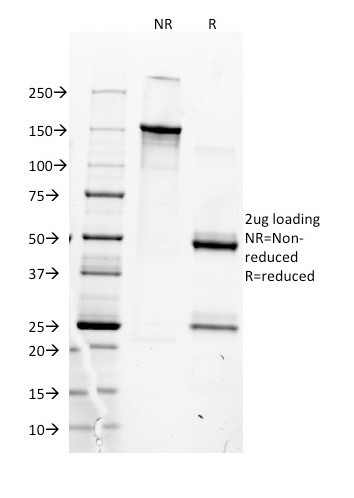 MyoD1 (Rhabdomyosarcoma Marker) Antibody in SDS-PAGE (SDS-PAGE)