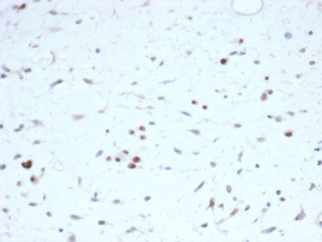 MyoD1 Antibody in Immunohistochemistry (Paraffin) (IHC (P))
