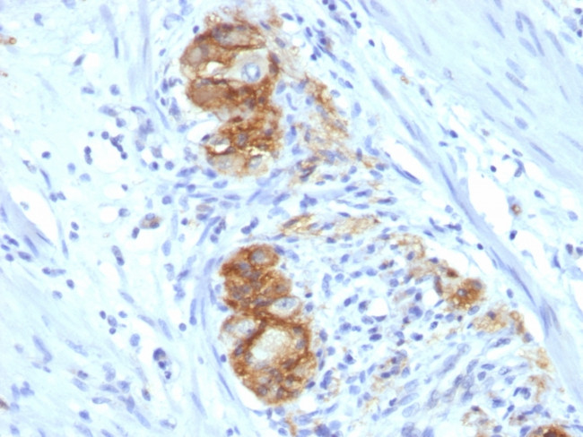 CD56/NCAM1/NKH1 (Neuronal Cell Marker) Antibody in Immunohistochemistry (Paraffin) (IHC (P))