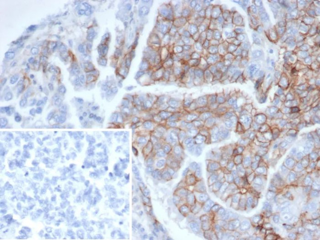 CD56/NCAM1/NKH1 (Neuronal Cell Marker) Antibody in Immunohistochemistry (Paraffin) (IHC (P))