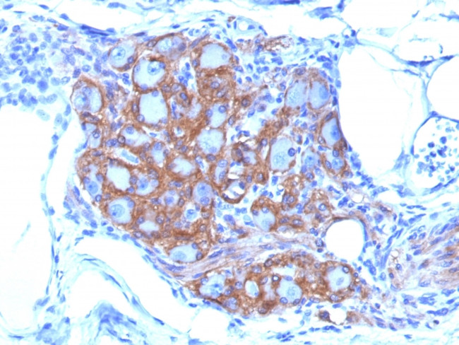 CD56/NCAM1 (Neuronal Cell Marker) Antibody in Immunohistochemistry (Paraffin) (IHC (P))