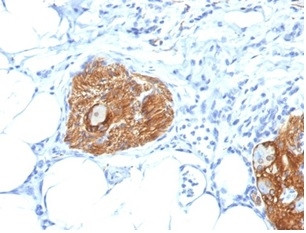 CD56/NCAM1/NKH1 (Neuronal Cell Marker) Antibody in Immunohistochemistry (Paraffin) (IHC (P))