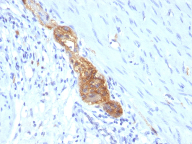 CD56/NCAM1 (Neuronal Cell Marker) Antibody in Immunohistochemistry (Paraffin) (IHC (P))