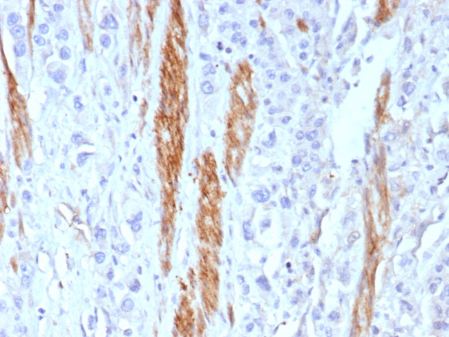 CD56/NCAM1/NKH1 (Neuronal Cell Marker) Antibody in Immunohistochemistry (Paraffin) (IHC (P))