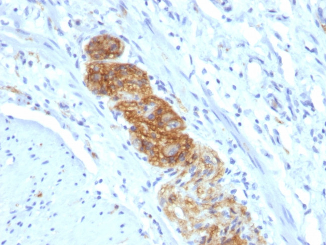 CD56/NCAM1/NKH1 Antibody in Immunohistochemistry (Paraffin) (IHC (P))