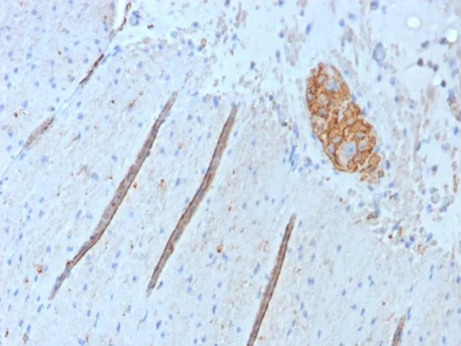 CD56/NCAM1/NKH1 (Neuronal Cell Marker) Antibody in Immunohistochemistry (Paraffin) (IHC (P))
