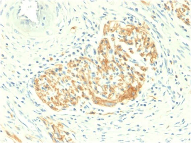 CD56/NCAM1/NKH1 Antibody in Immunohistochemistry (Paraffin) (IHC (P))