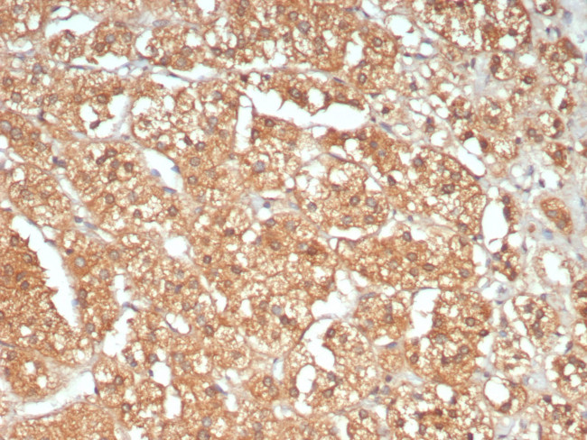 ATM/ATM serine/threonine kinase Antibody in Immunohistochemistry (Paraffin) (IHC (P))