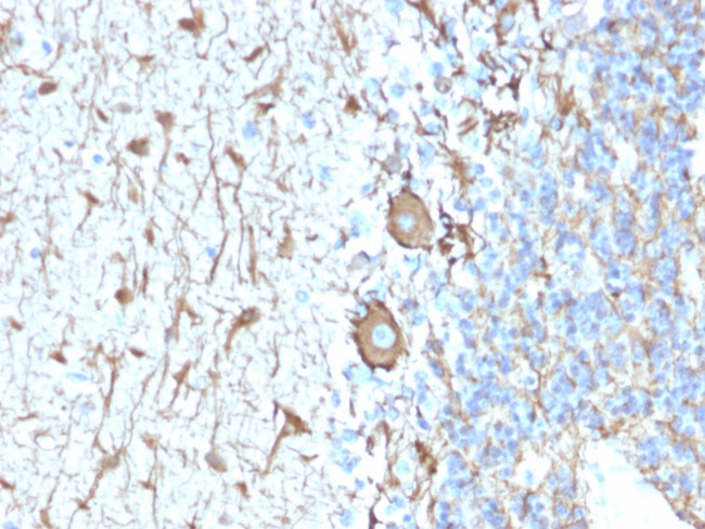 Neurofilament Antibody in Immunohistochemistry (Paraffin) (IHC (P))