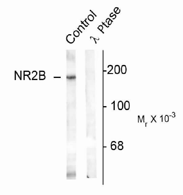 Phospho-NMDA NR2B (Tyr1336) Antibody in Western Blot (WB)
