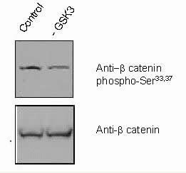 Phospho-beta Catenin (Ser33, Ser37) Antibody in Western Blot (WB)