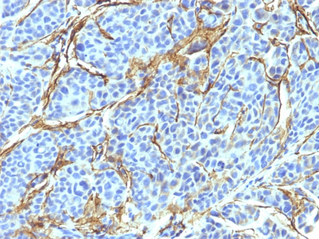 NGF-Receptor (p75)/CD271 (Soft Tissue Tumor Marker) Antibody in Immunohistochemistry (Paraffin) (IHC (P))