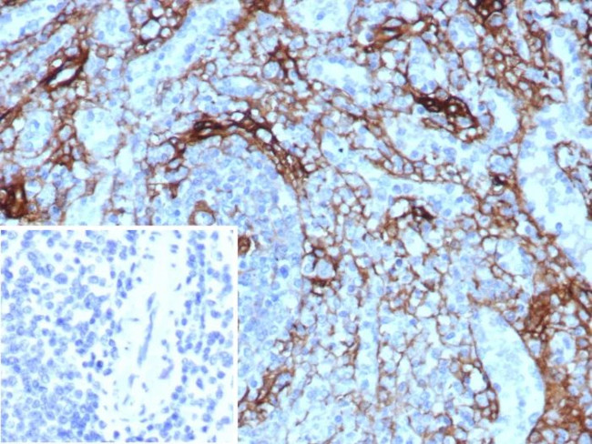 NGF-Receptor (p75)/CD271 (Soft Tissue Tumor Marker) Antibody in Immunohistochemistry (Paraffin) (IHC (P))