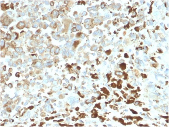 NGF-Receptor (p75)/CD271 Antibody in Immunohistochemistry (Paraffin) (IHC (P))
