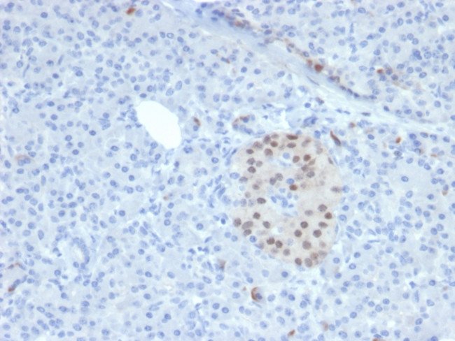 NKX6.1 (Marker for Pancreatic and Duodenal Neuroendocrine Tumors) Antibody in Immunohistochemistry (Paraffin) (IHC (P))