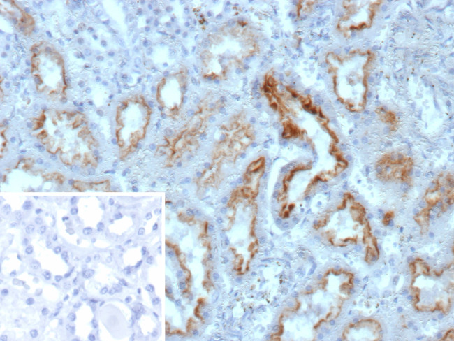 NME2/nm23-H2/NDPK-B (Suppressor of Metastasis) Antibody in Immunohistochemistry (Paraffin) (IHC (P))