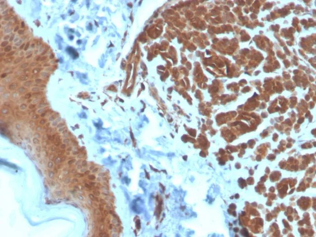 NME2/nm23-H2/NDPK-B (Suppressor of Metastasis) Antibody in Immunohistochemistry (Paraffin) (IHC (P))