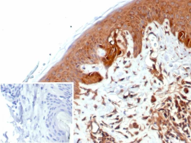 NME2/nm23-H2/NDPK-B (Suppressor of Metastasis) Antibody in Immunohistochemistry (Paraffin) (IHC (P))