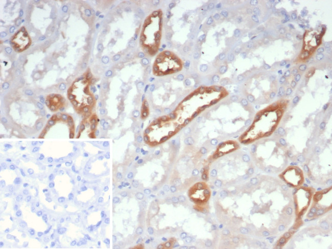 NME2/nm23-H2/NDPK-B (Suppressor of Metastasis) Antibody in Immunohistochemistry (Paraffin) (IHC (P))