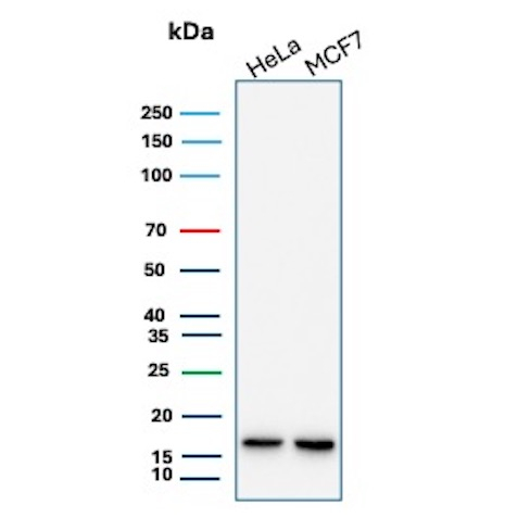 NME2/nm23-H2/NDPK-B (Suppressor of Metastasis) Antibody in Western Blot (WB)