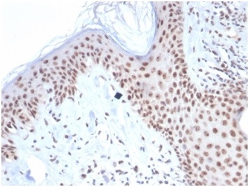 Nucleophosmin (Acute Myeloid Leukemia Marker) Antibody in Immunohistochemistry (Paraffin) (IHC (P))