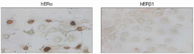 Estrogen Receptor alpha Antibody in Immunocytochemistry (ICC/IF)