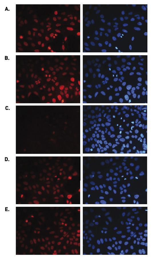 H3K36me1 Antibody in Immunocytochemistry (ICC/IF)