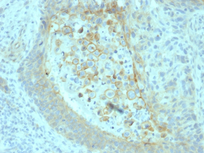 CD73 (Immuno-Oncology Target) Antibody in Immunohistochemistry (Paraffin) (IHC (P))