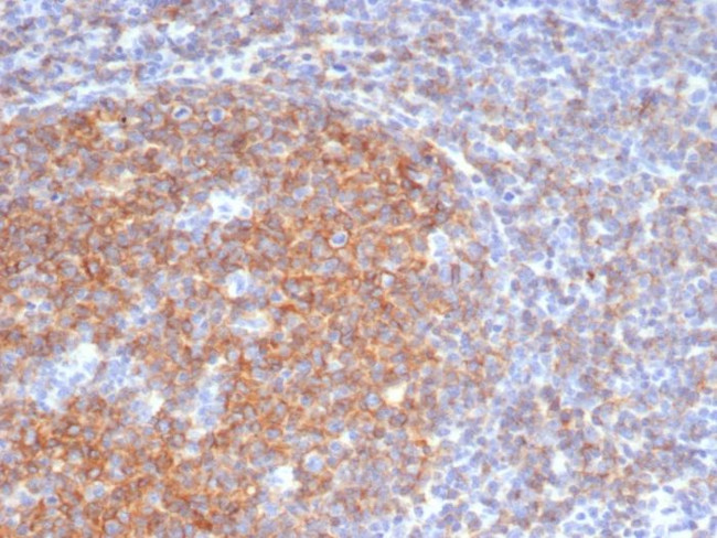 CD73 (Immuno-Oncology Target) Antibody in Immunohistochemistry (Paraffin) (IHC (P))