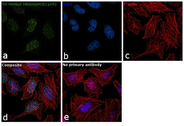 H3K9me3 Antibody in Immunocytochemistry (ICC/IF)