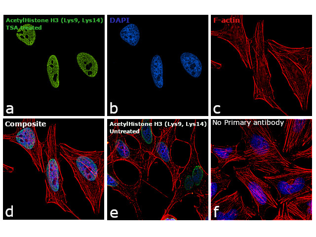 H3K9acK14ac Antibody in Immunocytochemistry (ICC/IF)