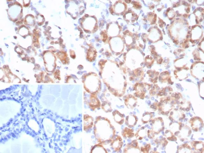 NTRK2 (Neurotrophic Receptor Tyrosine Kinase 2) Antibody in Immunohistochemistry (Paraffin) (IHC (P))