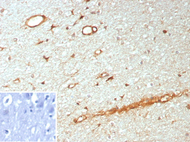 NTRK3 (Neurotrophic Receptor Tyrosine Kinase 3) Antibody in Immunohistochemistry (Paraffin) (IHC (P))