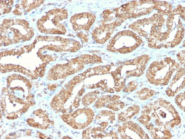 Ornithine Decarboxylase-1 (ODC-1) Antibody in Immunohistochemistry (Paraffin) (IHC (P))