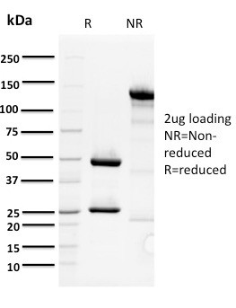 ORC1 Antibody in SDS-PAGE (SDS-PAGE)