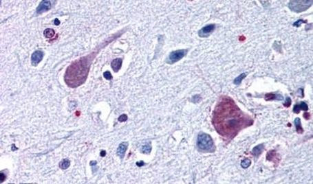 HTR2B Antibody in Immunohistochemistry (Paraffin) (IHC (P))