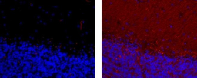 CD56 (NCAM) Antibody in Immunohistochemistry (Paraffin) (IHC (P))
