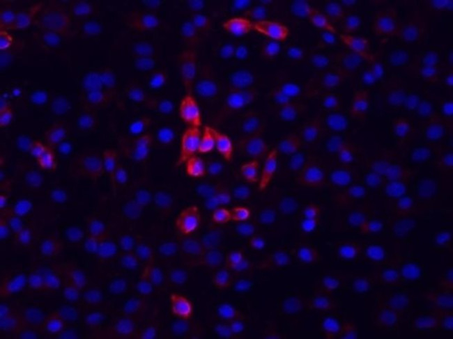Mouse IgM Antibody in Immunocytochemistry (ICC/IF)