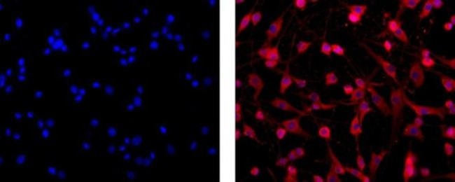 Oligodendrocyte Marker O1 Antibody in Immunocytochemistry (ICC/IF)