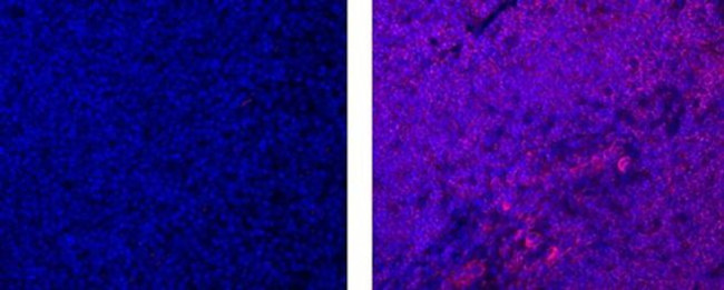 Phospho-BTK/ITK (Tyr551, Tyr511) Antibody in Immunohistochemistry (Paraffin) (IHC (P))