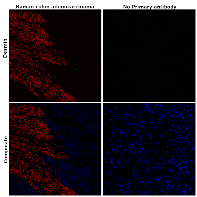 Desmin Antibody in Immunohistochemistry (Paraffin) (IHC (P))