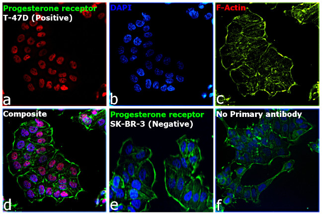 Progesterone Receptor Antibody in Immunocytochemistry (ICC/IF)