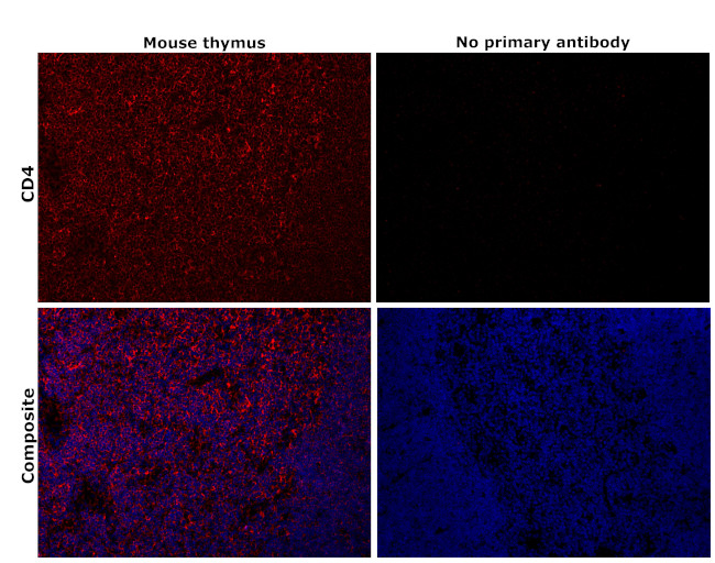 CD4 Antibody in Immunohistochemistry (Paraffin) (IHC (P))
