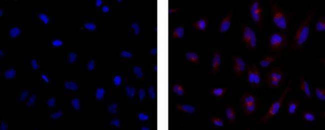 Golgin-97 Antibody in Immunocytochemistry (ICC/IF)