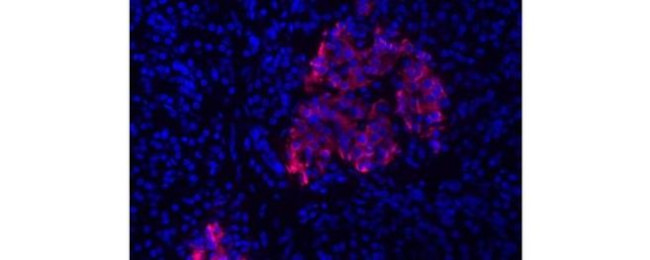Insulin Antibody in Immunohistochemistry (Paraffin) (IHC (P))