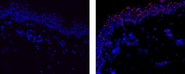RUNX3 Antibody in Immunohistochemistry (Paraffin) (IHC (P))