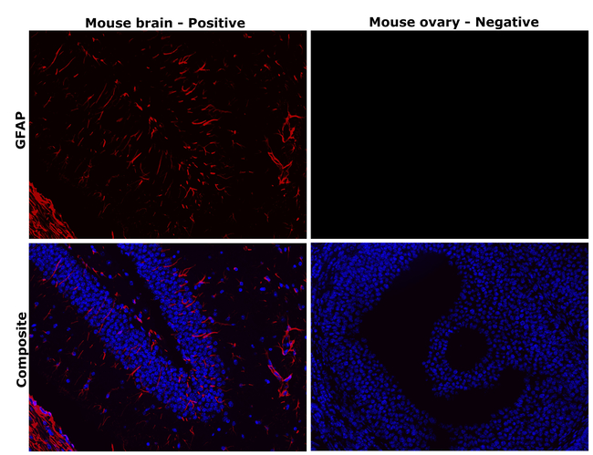 GFAP Antibody in Immunohistochemistry (Paraffin) (IHC (P))