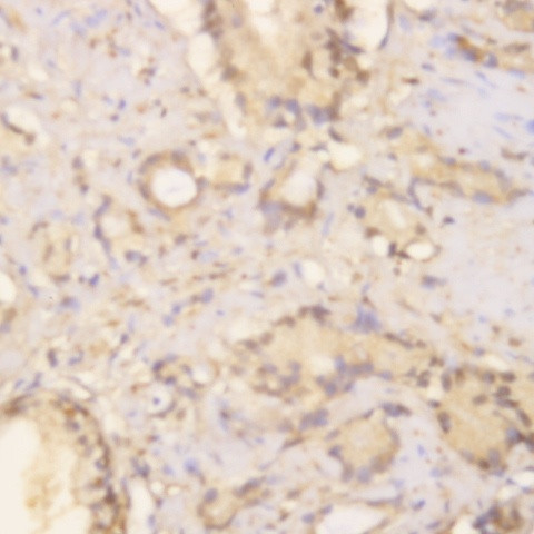Phosphoserine Antibody in Immunohistochemistry (Paraffin) (IHC (P))